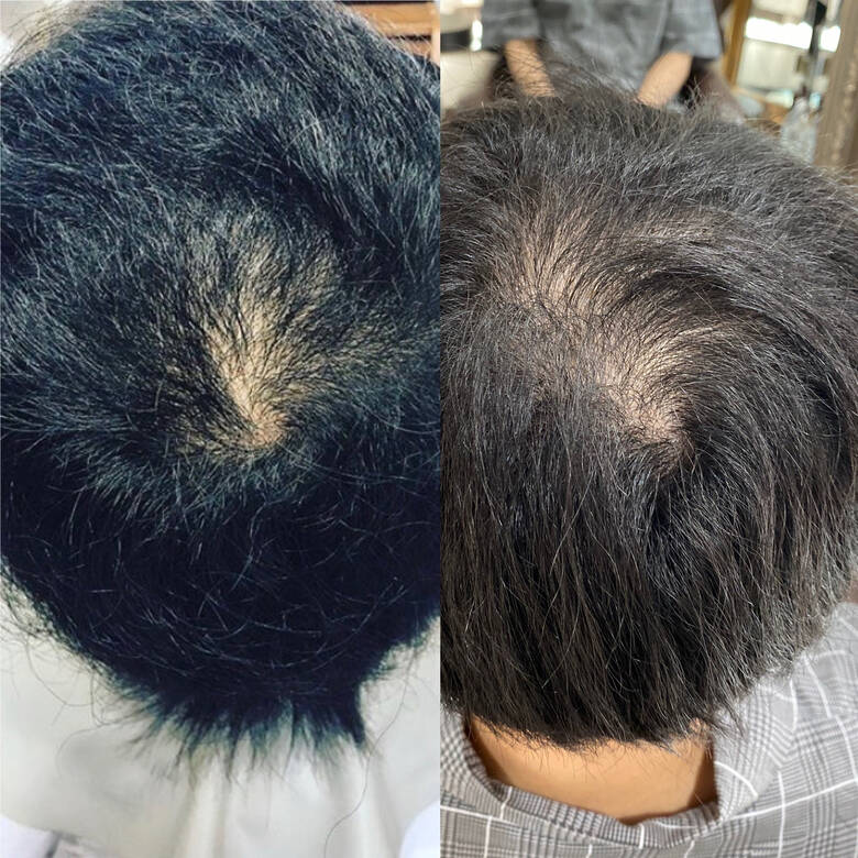 ナチュラル ショート 薄毛改善 Aime 髪質改善師エイ Hair