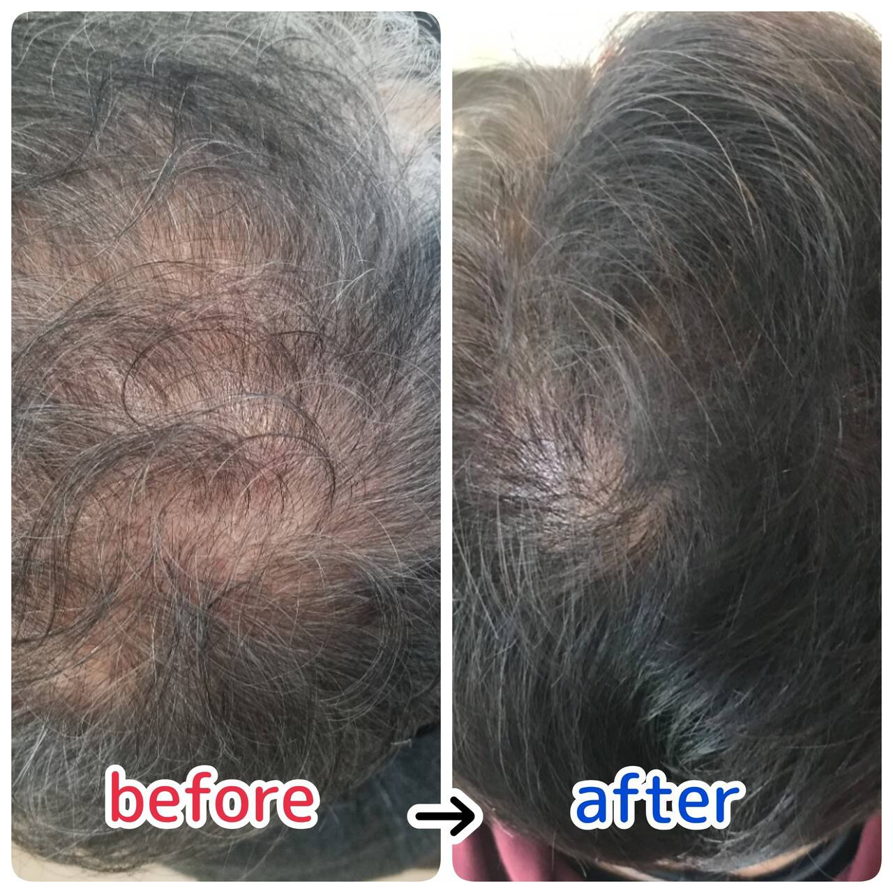 ショート ナチュラル 頭皮ケア 薄毛改善 頭皮と髪の病院メディカルサロン ルーミールーム 頭皮と髪の病院 ルーミールーム Hair