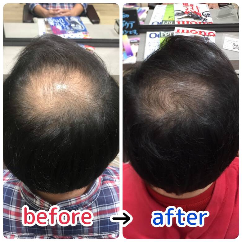 ベリーショート 薄毛改善 頭皮ケア ショート 頭皮と髪の病院メディカルサロン ルーミールーム 頭皮と髪の病院 ルーミールーム Hair