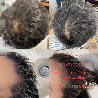 2020年夏版 薄毛改善 最新髪型 アレンジのヘアカタログ Hair 2020年夏版 薄毛改善 最新髪型 アレンジのヘアカタログ Hair